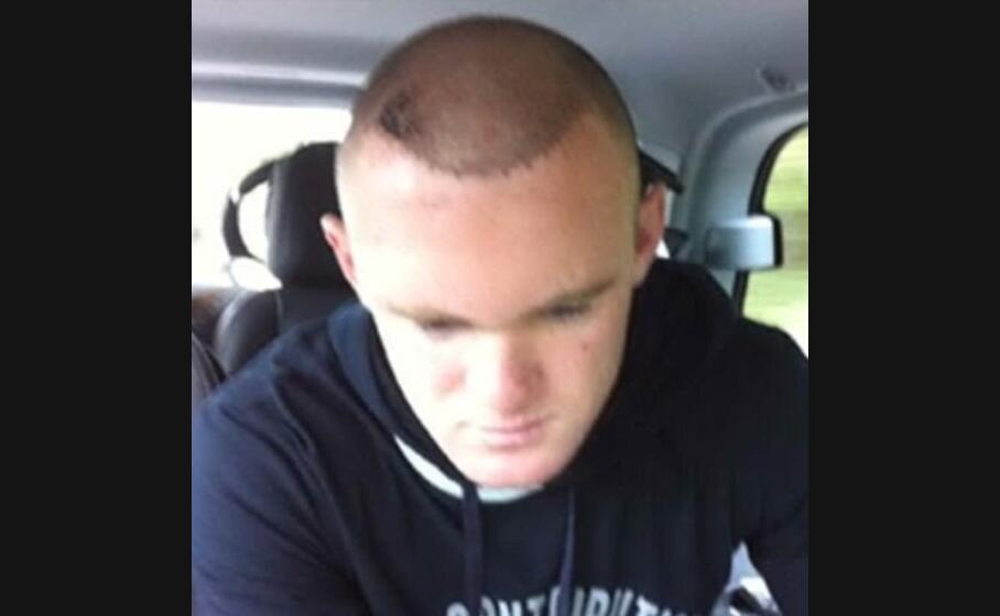 Rooney su Twitter dopo il trapianto - L'Unione Sarda.it