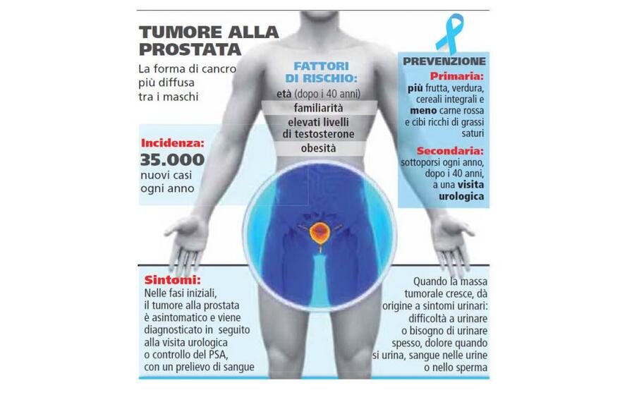 5 per mille 2020 cancro alla prostata 5 per mille 2020 cancro alla prostata