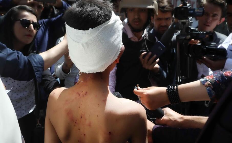 un bambino ferito (ansa)