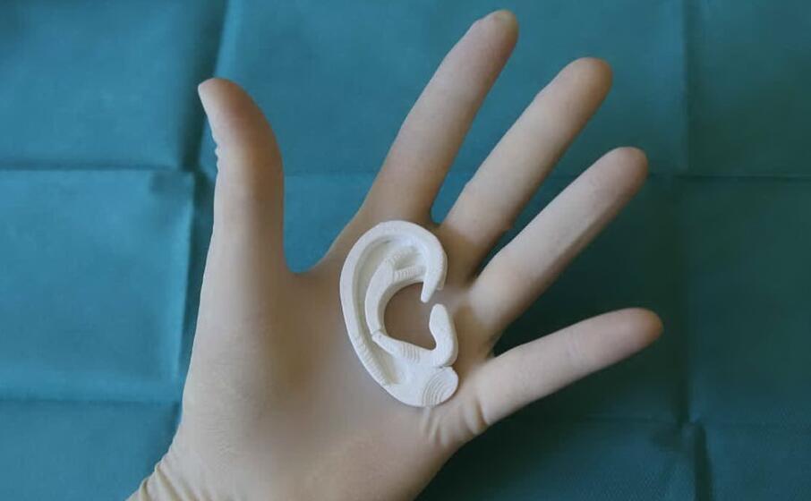 il modello dell orecchio del bimbo realizzato in laboratorio (foto fondazionemeyer)