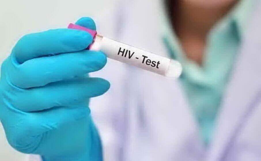 il test dell hiv (archivio l unione sarda)