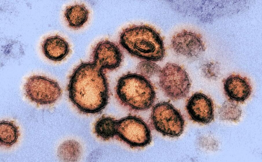 (il virus della sars in un immagine del national institute of health)