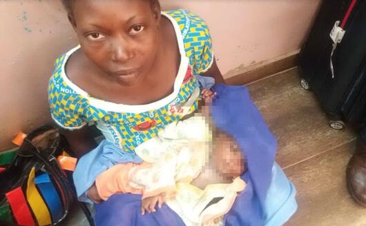 Gemelline Siamesi Separate Al Bambino Gesu Di Roma L Unione Sarda It