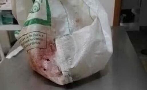 La busta insanguinata (foto Facebook)