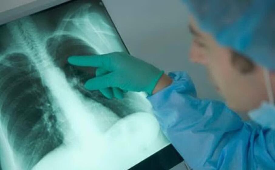 la lettura di una radiografia (archivio u s )